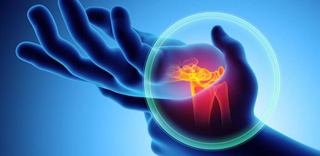 Do desconforto ao afastamento: o custo invisível da LER/DORT para as empresas